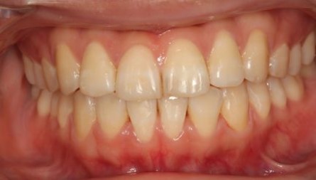 Orthodontics Epsom