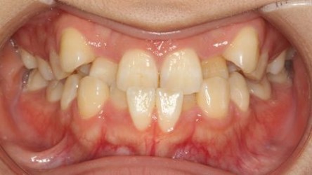 Orthodontics Epsom